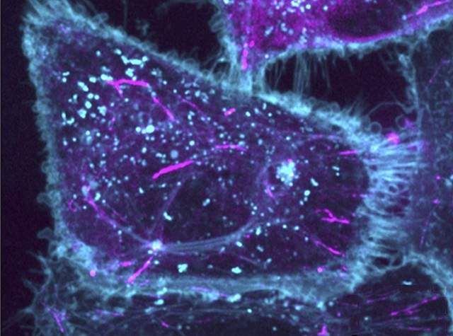 Trapezoide amb fils blaus al seu perímetre, l’interior té un fons negre amb punts blaus dispersos com gotes de llum.