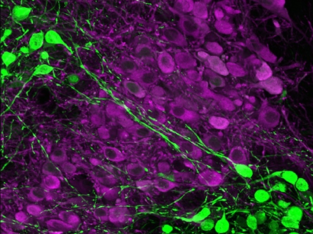 Conjunt d'esferes allargades i irregulars, les del fons són de color morat, mentre que les dels extrems superior esquerre i inferior dret, són verdes.
