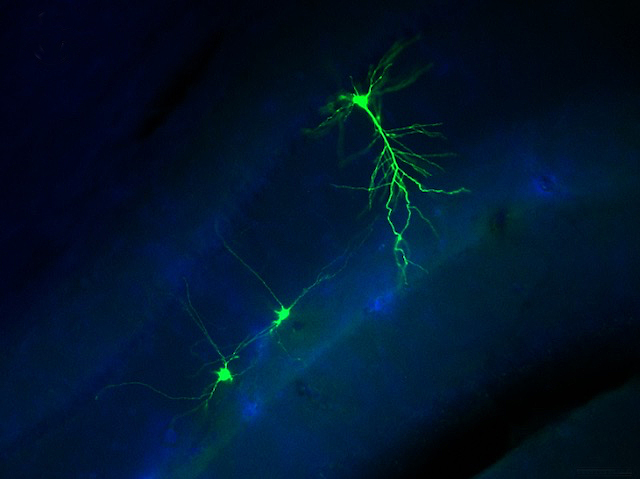 tres neurones verdes, amb ramificacions, sobre un fons fosc i alguna zona blava
