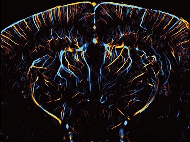 una secció de cervell a la que se li veueu filaments (vasos sanguinis) de color blau i groc des de la superfície cap a l'interior