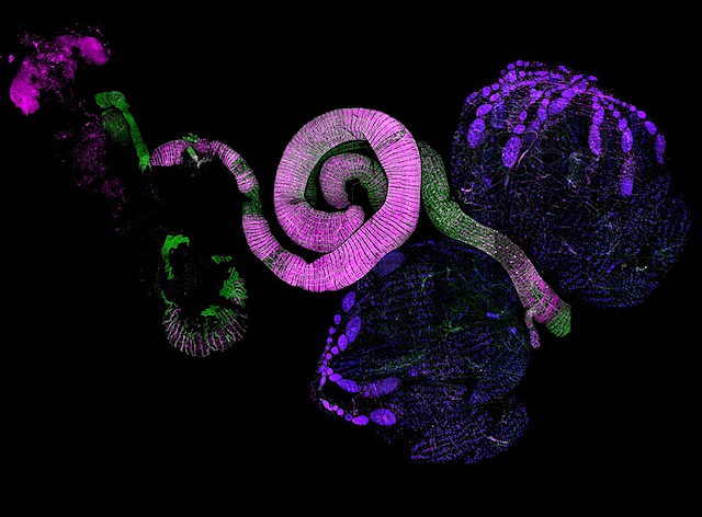 un tub rosa amb un segment enrotllat, amb dos paquets foscos al costats d'un dels extrems del tub