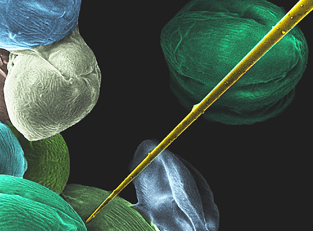 un filament groc junt estructures globoses de color verdós o blanc