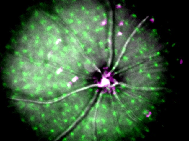 Un cercle (la retina) amb diversos punts verds i algun magenta