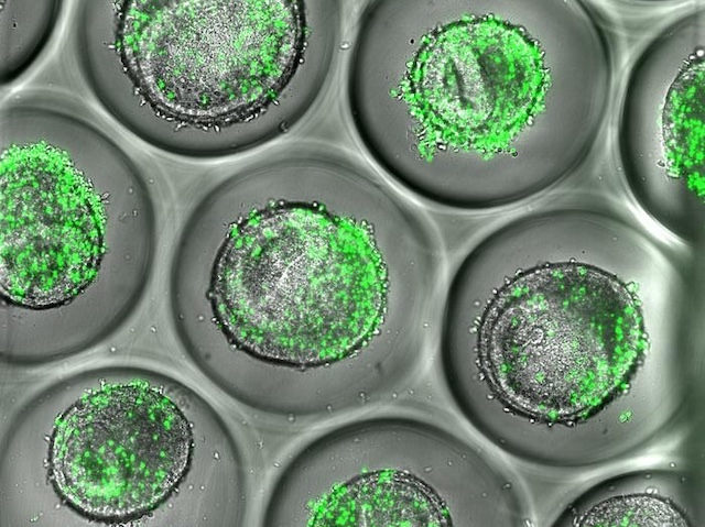 Diversos cercles (organoides) amb nombrosos punts verds