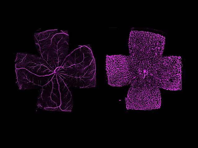 Una forma rodona amb prolongacions que s’estenen des del centre, mostrant zones plenes i altres amb xarxes fines.