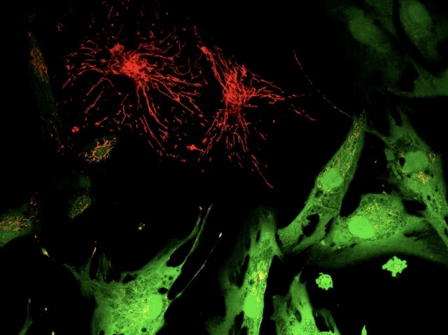 Figures amb forma triangular i amb forma de dendrites com les de una neurona, amb contorns definits i estructures internes filamentoses i compactes.