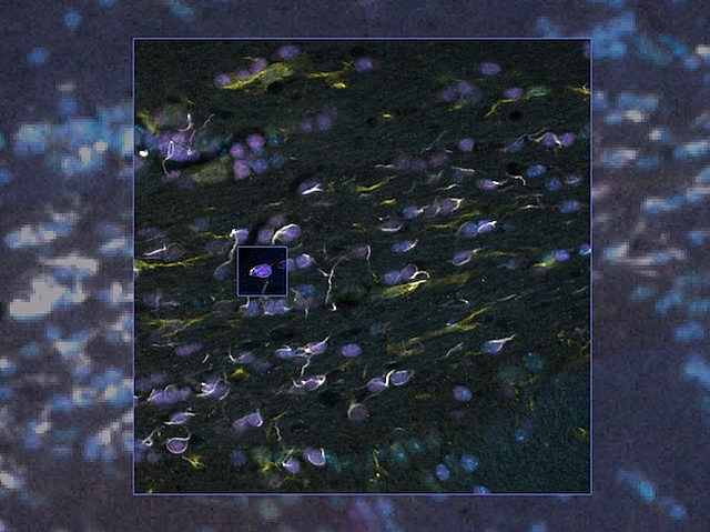 Es veuen filets blancs adherits a taques circulars blavoses.