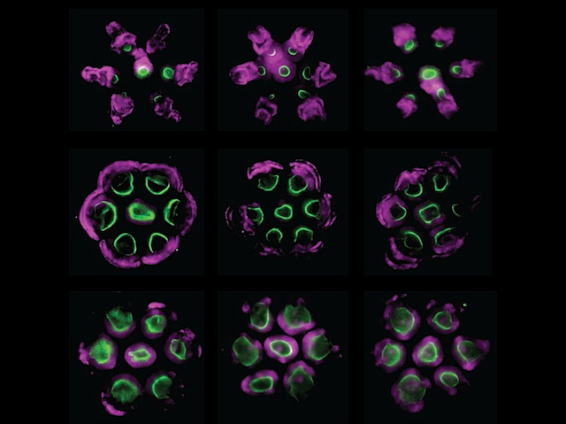 Es veuen tres línies amb tres talls cada una que mostren diferents patrons o disposicions de teixit on unes capes morades envolten de diverses maneres taques verdes.
