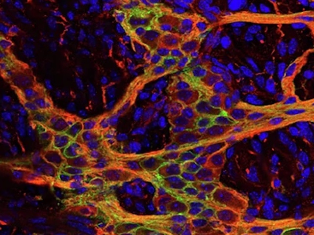 un conjunt d'elements ovalats blaus entre els quals es veuen alguns filament ataronjats