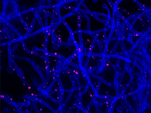 molts filaments blaus, creuats, amb algun punt rosa sobre ells