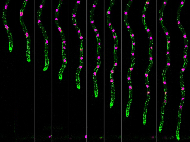 onze imatges d'un filament verdós, cada vegada més llarg, amb uns pocs punts rosa en la seua longitud