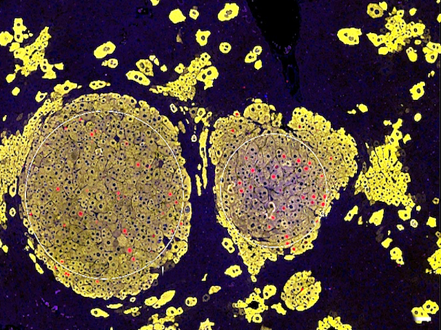 grups de cèl·lules menudes de color groc en el que unes tenen un punt roig damunt